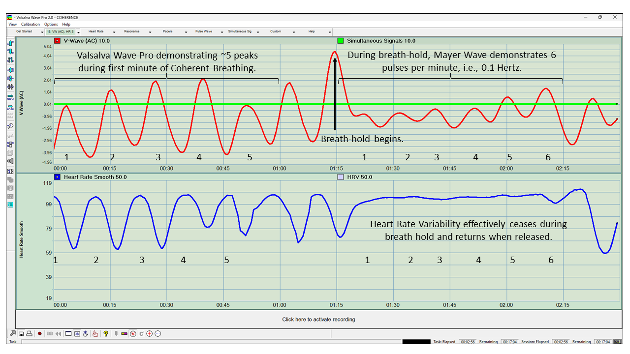 Valsalva Wave Pro Demonstrating The Mayer Wave